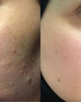 best facial oil australia
