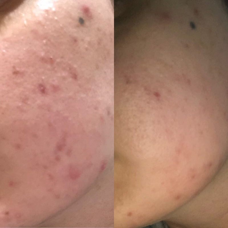 australian skincare brands 